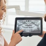Имплантация зубов: инновационные методики и технологии